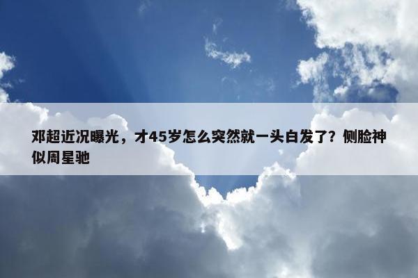 邓超近况曝光，才45岁怎么突然就一头白发了？侧脸神似周星驰